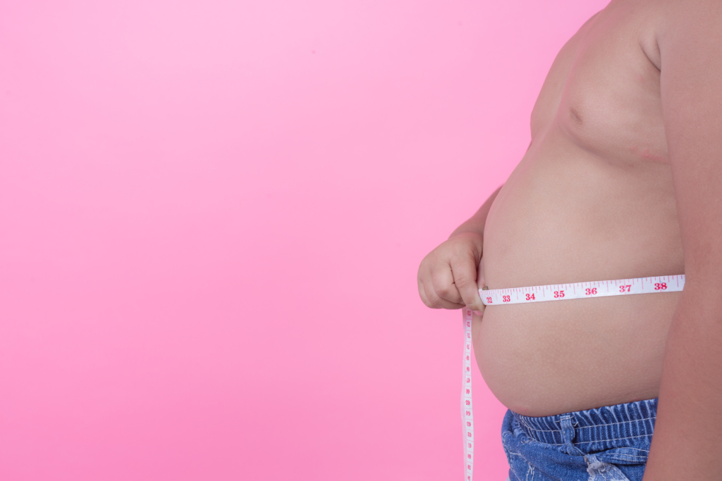 Insulino resistenza associata a sindrome metabolica con obesità addominale