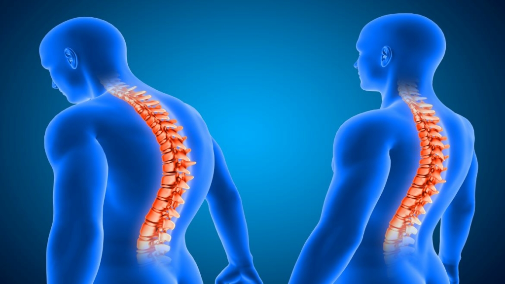 Il mal di schiena è legato a posture sbagliate dovute molte volte al sovrappeso.